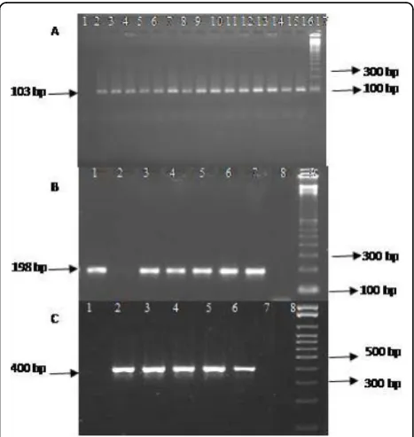 Figure 1 Agarose gel electrophoresis of PCR products stainednegative sample, 2-5: positive samples, 6: positive control, 7:15: positive samples, 16: positive control and 17: molecular weight(100 bp), Bsample, 3-6: positive samples, 7: positive control, 8: negative controland 9: molecular weight (100 bp), Cwith Syber Safe : A ® icaA gene (103 bp), 1: negative control, 2- ® icaD gene (198 bp), 1: positive sample, 2: negative ® icaC gene (400 bp), 1:negative sample, 8: negative control, 9: molecular weight (100 bp).