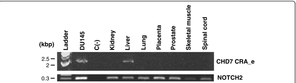 Figure 4 RT-PCR analysis of the CHD7 CRA_e transcript expression in normal human tissue total RNA samples