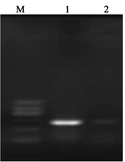 Figure 1. M, DNA marker; 1 and 2, AKT2 CDS PCR amplification fragment.