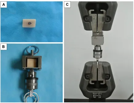 Figure 1 Procedures of the pull-out test.Notes: (A) The implant–bone blocks were embedded in poly(methyl methacrylate) resin, (B) the sample was fixed in a tensile test box, and (C) the box was stabilized in the electronic universal material test machine.