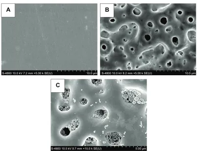 Figure 2 characterization of BBF-loaded Plla nanoparticles.Notes: (A) Scanning electron microscope image at low magnification, (B) scanning electron microscope image at high magnification, and (C) size distribution.Abbreviations: BBF, (Z-)-4-bromo-5-(bromomethylene)-2(5H)-furanone; Plla, poly(l-lactic acid).