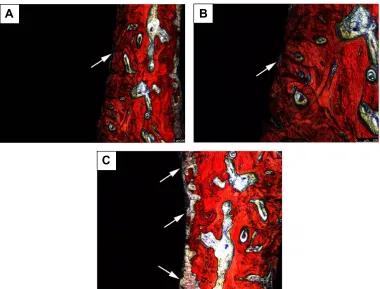 Figure 5 scanning electron microscope images of polished cross-sections of the implants in bone of different groups after 2-month implantation.Notes: (A) experimental group, (B) positive control group, and (C) blank control group.Abbreviation: Ti, titanium.