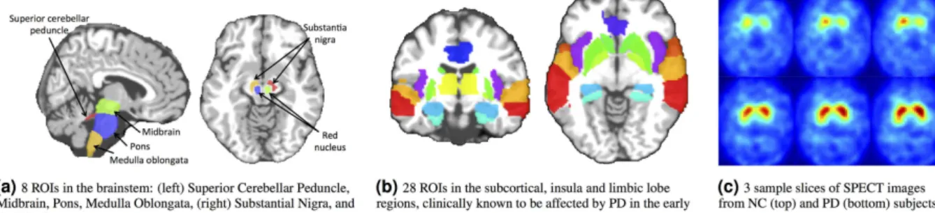 Figure 2.  ROIs from MRI and SPECT used in this study. 