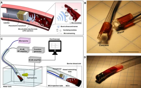 Figure 1.  Microbubble-mediated intravascular sonothrombolysis system. (A) Principle of microbubble- microbubble-mediated intravascular sonothrombolysis by using a catheter-tipped forward-looking transducer;  low-frequency ultrasound waves generate stable 