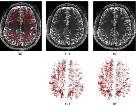 Figure 8 shows the box plots of the segmentation accuracies for the three types of images, i.e., (1) the original 7 T  MR images, (2) the denoised images (by directly applying BM4D on the original 7 T MR images), and (3) our  enhanced and denoised images (