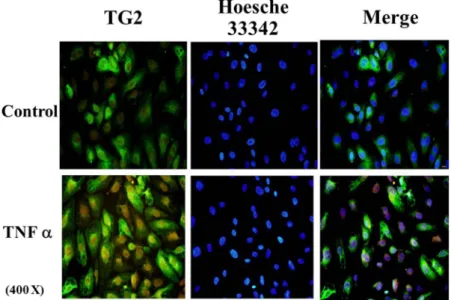 Figure 1.  Immunofluorescent staining of TG2 in TNFα-treated HUVEC cells. HUVEC cells were grown  and treated with or without TNFα (10 ng/ml) for 5 hours