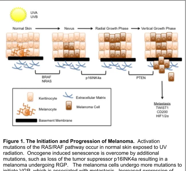 Figure 1. The Initiation and Progression of Melanoma.  Activation  mutations of the RAS/RAF pathway occur in normal skin exposed to UV  radiation