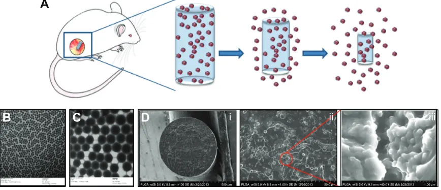 Figure 1 INCeRT platform schematic diagram and high magnification electron microscopy images of spacers.Notes: (A) Illustration of intradermal spacer diffusion