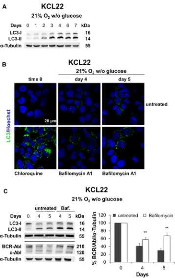 Figure 7: Role of autophagy in BCR/Abl protein suppression under glucose shortage. KCL22 cells were incubated at 21% O2 in the absence of glucose for the indicated times