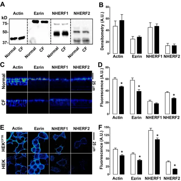 Figure 1.  CFTR affects the near-membrane organization of scaffolding proteins. Open bars, normal or  CFTR-expressed; closed bars, CF or null as appropriate