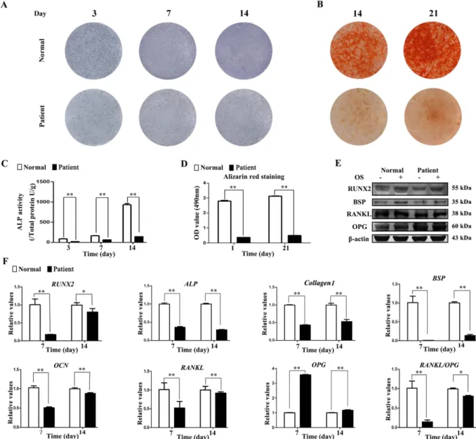 Figure 1.  TDO-BMSCs exhibit weaker osteogenic potential than CON-BMSCs. TDO- and CON-BMSCs  at passage 3 were cultured under osteoinduction medium