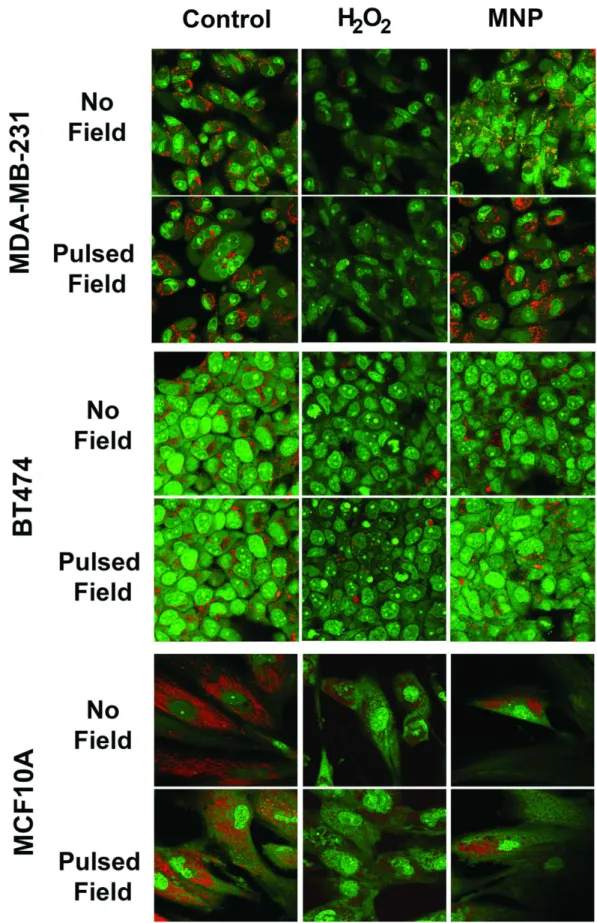 Figure 4.  LMP detection using acridine orange in SMNP-treated MDA-MB-231, BT474 and MCF10A cells  before and after pulsed field exposure