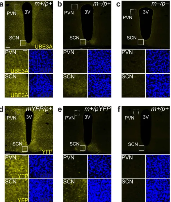 Figure 2.  Paternal UBE3A expression in the SCN but not the PVN in AS model mice. (a–c) Confocal  micrographs of UBE3A immunofluorescence in hypothalamic regions surrounding the third ventricle  in Ube3a m+/p+  (a), Ube3a m–/p+  (b), and Ube3a m–/p–  (c) m