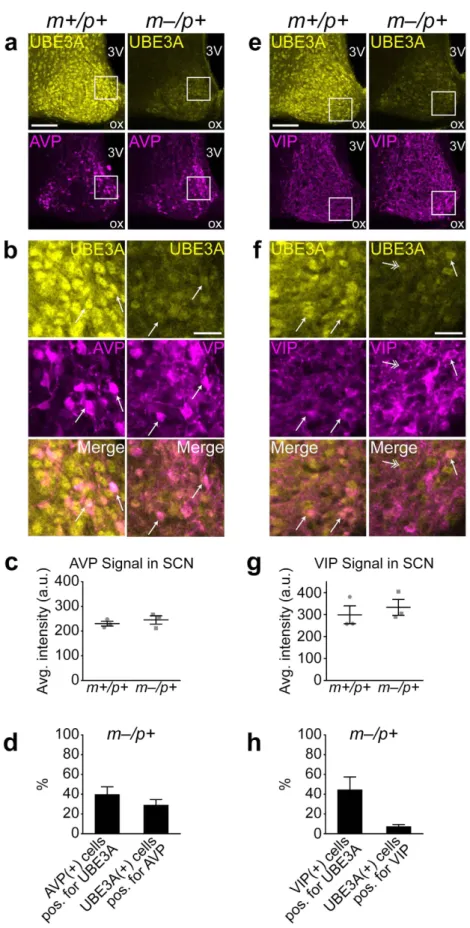 Figure 4.  Colocalization of UBE3A with AVP and VIP in the SCN of AS model mice. (a) Representative  confocal images of immunofluorescent signals of UBE3A and AVP in coronal sections containing the SCN  from Ube3a m+/p+  and Ube3a m–/p+  mice sacrificed at