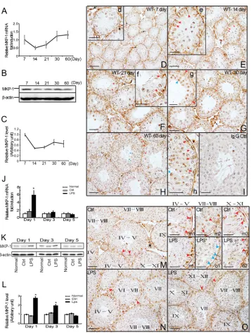 Figure 1: Expression and distribution of MKP-1 in the developing testes and LPS-induced acute testis inflammation.Detection of MKP-1 expression in the developing testes (day 7 to day 60) was performed by realtime PCR A