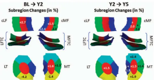 Figure 5. Baseline to Year 2 (Left) and Year 2 to Year 5 (Right) thickness  changes Eckstein 2014