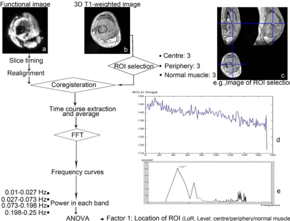 Figure 3.  Schematic illustration of the course to data processing and analysis. The selected patient is a  19-year-old man with osteosarcoma in his left femur