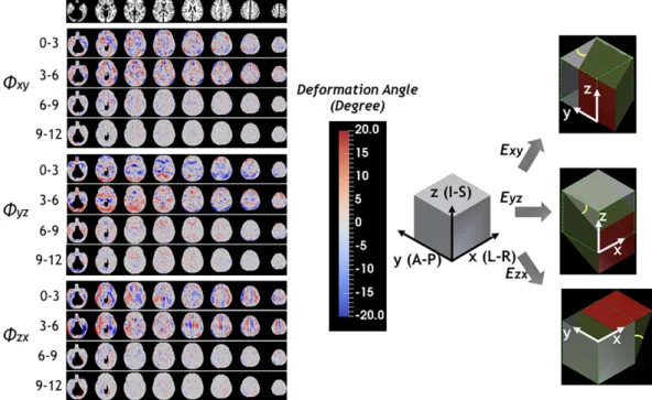 Figure 7.  Age effects on volumetric and directional growth rates of the brain. Most gray matter regions  show statistically significant age effects