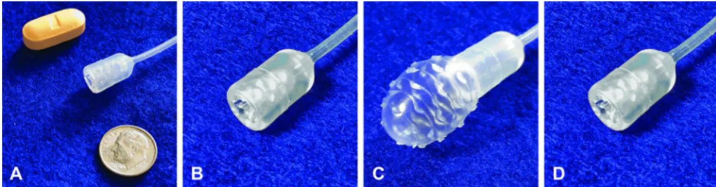 Figure 5. Non-endoscopic balloon device