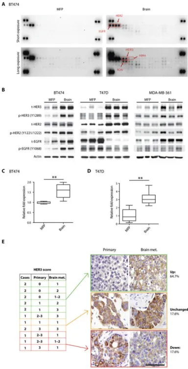 Fig. 2. HER3 is overexpressed and hyperactivated in BMs