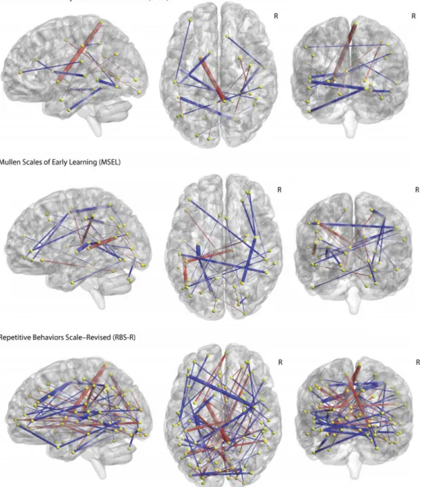 Fig. 2. Differences in functional connectivity in ASD infants versus non-ASD infants