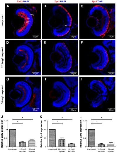 Figure 5 Neuronal differentiation in retinas following exposure to copper oxide nanoparticles.Notes: (A–I) Sections taken through the retinas at 72 hours postfertilization