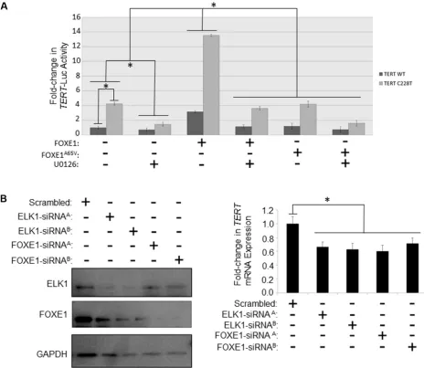Figure 3: FOXE1 regulates TERT transcription in thyroid cancer cells. (A) Determination of the transcriptional activity of FOXE1 upon the TERT gene promoter. KTC1 cells were transiently transfected with either wild-type or C228T TERT-luc, and different com