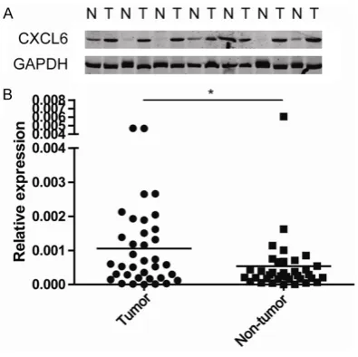 Figure 2. The CXCL6 expression level in HCC tumor ern blot assay and qPCR assay. The CXCL6 expres-sion level was higher in tumor tissue than non-tumor tissue and non-tumor tissue were detected by west-tissue in qPCR (B) and Western blot results (A).