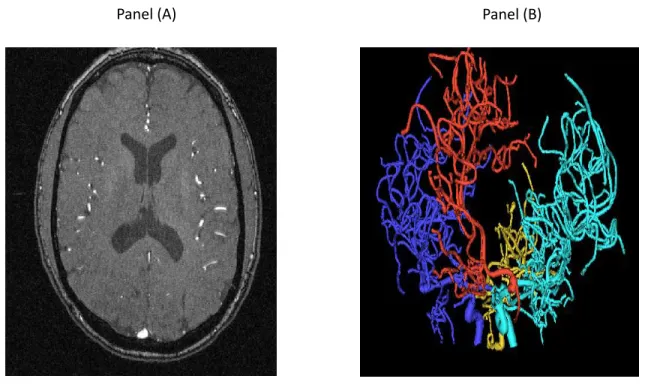 Figure 4.1: A single slice MRA image for one person