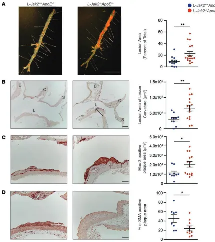 Figure 1. Accelerated atherosclerosis with hepatic Jak2L-Jak2and each of the panels, each dot in the scatter plot indicates an individual animal