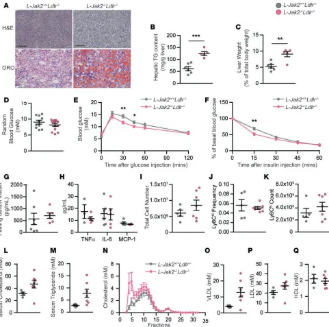 Figure 5. L-Jak2L-Jak2Distribution of serum cholesterol among lipoprotein fractions determined by fast performance liquid chromatography (FPLC) and total serum VLDL, LDL, and HDL cholesterol were quantified from FPLC serum lipoprotein profiles from in over