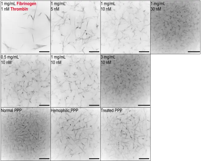 Figure 2.2: Confocal microscopy of the clot types studied in this work. As has been well established in prior work, clot coarseness decreases with thrombin  con-centration (first row) and fibrinogen concon-centration (middle row)
