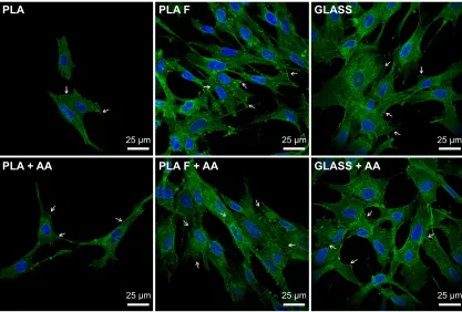 Figure 7 relative expression of fibrin nanocoating (F) determined by real-time PCR.β1-integrins in human dermal fibroblasts on days 7, 10, and 14 after seeding on nonmodified PLA membranes or on PLA membranes with a Notes: The cells were cultivated in the 