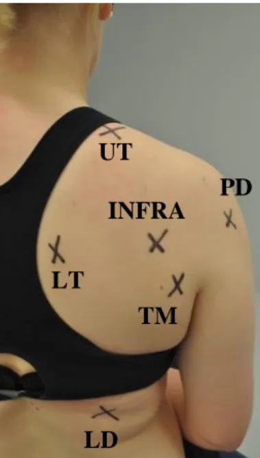 FIGURE 4: Myotonometer Probe Locations 