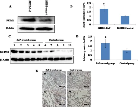 Figure 2: STIM1 expression in malignant 16HBE cells transformed by BaP and BaP-treated mice lung tissues were measured by qRT-PCR and western blot assay