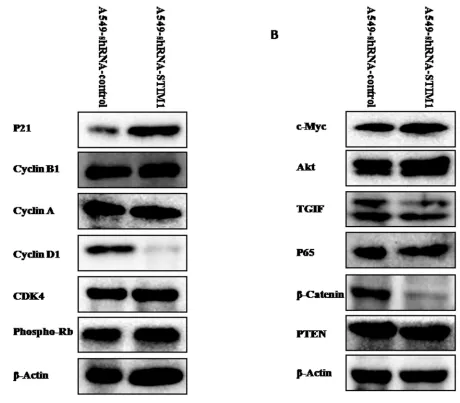 Figure 6: Effects of silencing STIM1 on the expression of several proteins. Western blot analysis showed that silencing STIM1 decreased cyclin D1, TGIF and β-catenin expression and increased p21 expression.