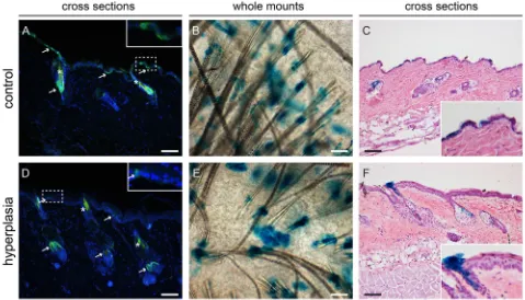 Figure 7). And again, Lgr6 progeny was present in HFs 