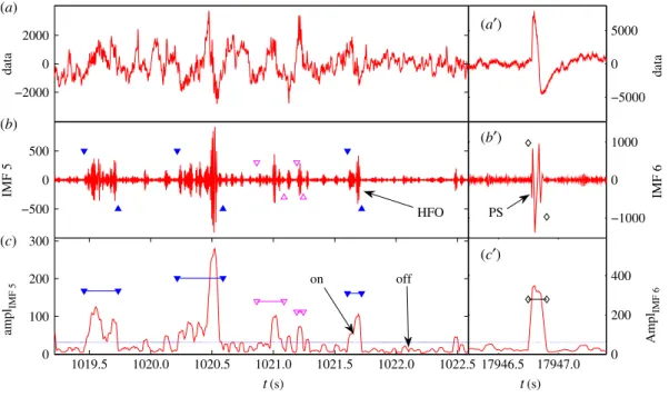 Figure 7. Example of successful HFO and PS detection. (a) Original EEG data plot of about 3 s