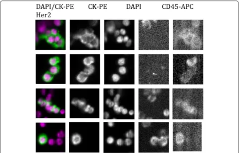 Fig. 4 Representative images of a patient with CTC clusters. Shown are representative images of a patient with CTC clusters with nuclear (DAPI)andand cytokeratin (CK-PE) staining