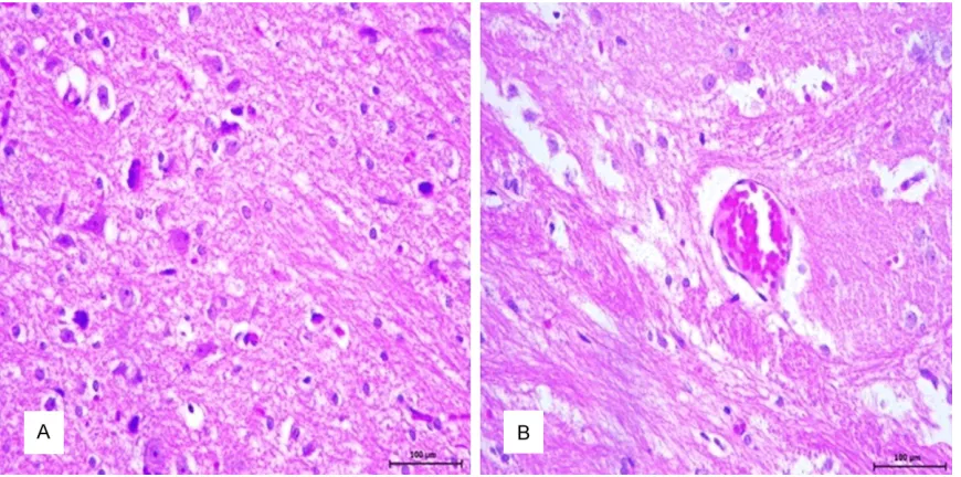 Figure 1. Neuronal necrosis areas were observed. H&E Bar, 100 μm (A) Neuronal necrosis areas and hyperaemia were observed