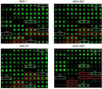 Figure 1: Glycan profiles of gastric cancer and normal gastric cell lines obtained by lectin microarray analysis