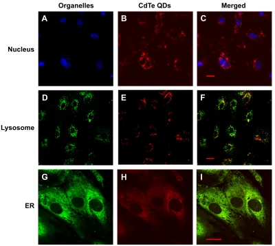 Figure 4 colocalization of cdTe QDs and intercellular organelles.Notes: hUVecs were incubated with 10 µg/ml cdTe QDs for 24 hours, and the nucleus, lysosomes, or er was labeled with hoechst 33342, lysotracker green, or immunofluorescence, respectively