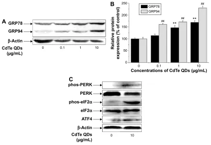 Figure 6 Induction of morphological changes of er in hUVecs.Notes: cells were treated with 10 µg/ml cdTe QDs for 24 hours