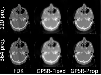 Figure 4: Reconstructed images of a head-and-neck patient sample using 120 and 364 projections