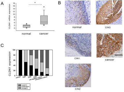 Figure 2: CLDN1 expression is increased in CIN and cervical cancer. A. Reverse-transcription qPCR was used to detect the expression of CLDN1 mRNA in 73 fresh cervical cancer tissues and 20 normal cervical tissues