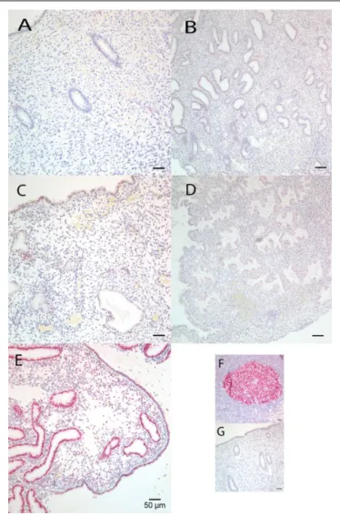Figure 2. Representative B-Cell CLL/Lymphoma 6 (BCL6) protein immunostaining expression in endometrial paraffin sections over the menstrual cycle