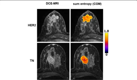 Fig. 2 Original CE-MRI images and corresponding color-coded sum entropy feature map as overlay of the tumor area of triple-negative (TN) andHER2-enriched (HER2) breast cancer