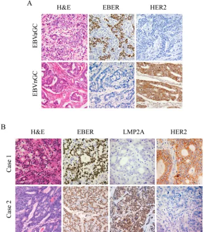 Figure 2: LMP2A inhibited expression of HER2, TWIST and YB-1 on both transcriptional and translational levels