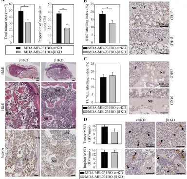 Figure 4: β1 integrins promote tumor growth in bone by increasing cell proliferation in vivo