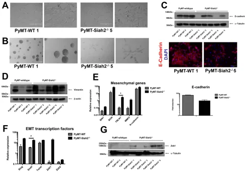 Figure 4: PyMT-Siah2-/- cell lines undergo spontaneous EMT. (A) Phase contrast images of PyMT-WT and PyMT-Siah2-/- cells in 2D culture